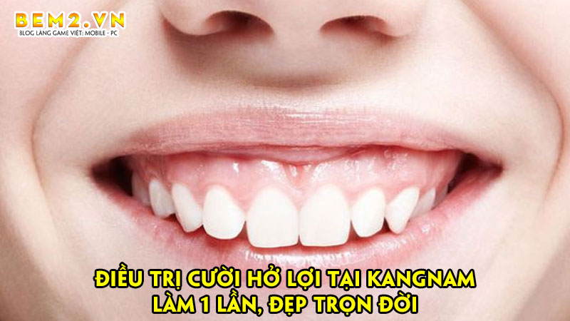 dieu-tri-cuoi-ho-loi-tai-kangnam-lam-1-lan-dep-tron-doi-bem2